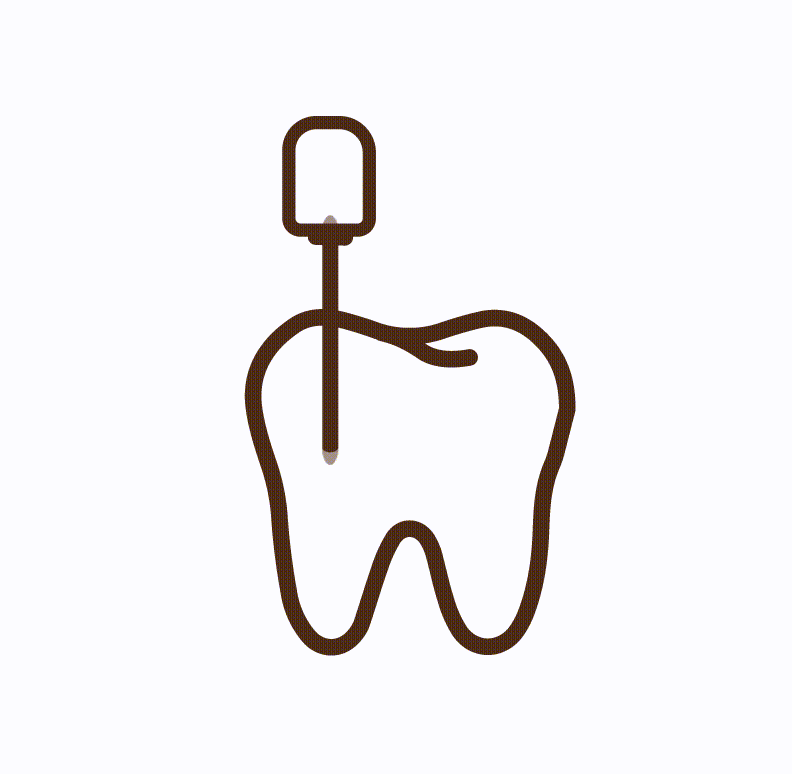 Root Canal